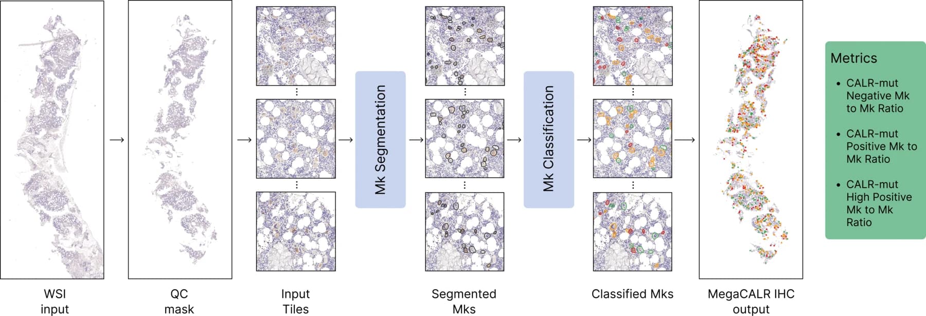 The MegaCALR pipeline: input tiles pass through a megakaryocyte segmentation model, then a classification model, producing a whole-slide map of classified megakaryocytes and per-class metrics.