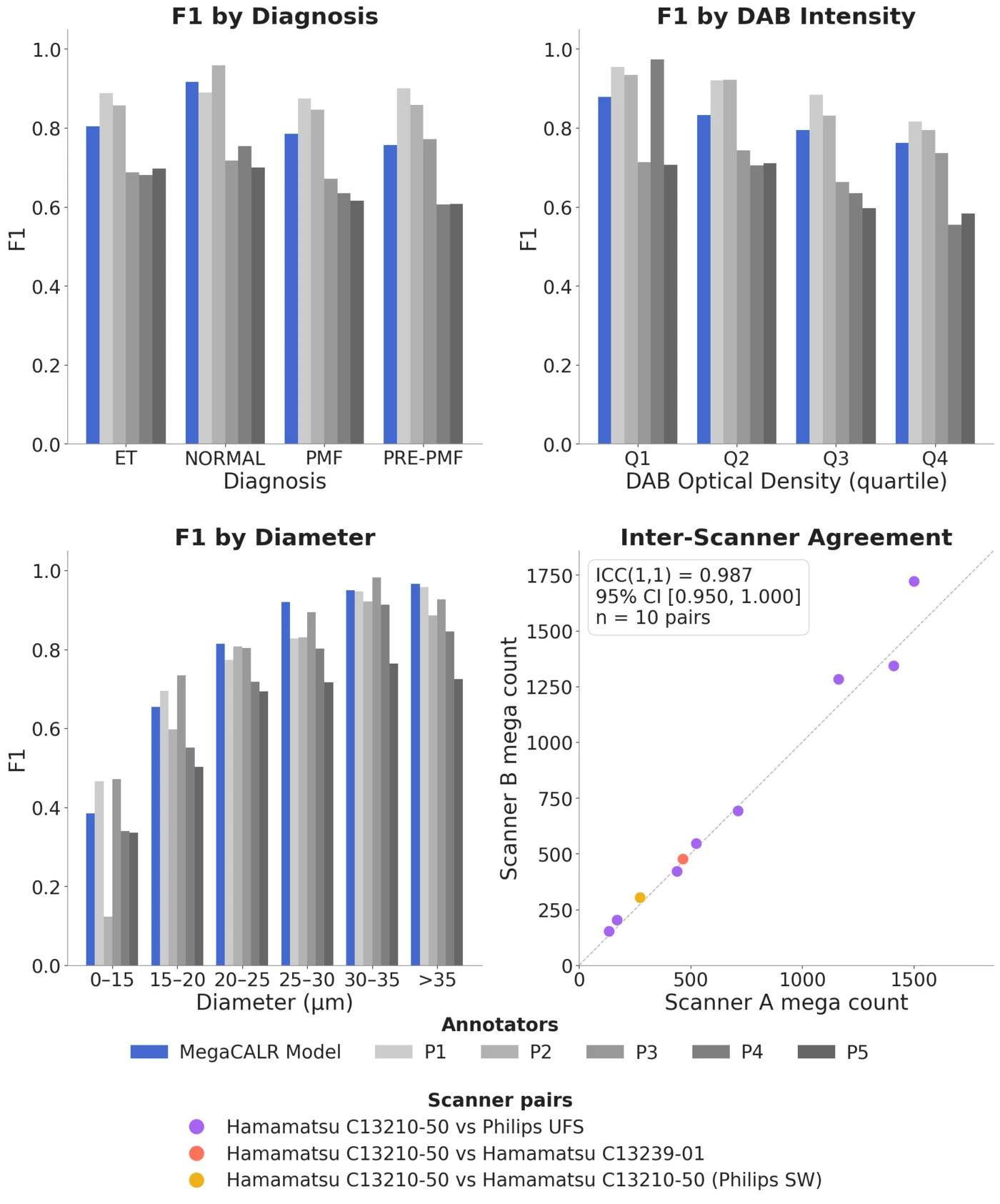 Segmentation F1 broken down by diagnosis, DAB stain-intensity quartile, and megakaryocyte diameter, alongside an inter-scanner agreement scatter plot. MegaCALR stays within the pathologist range across strata, and counts agree closely between scanners.