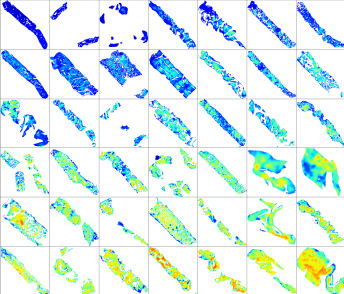 Illustration heterogeneity in fibrosis across a trail cohort.