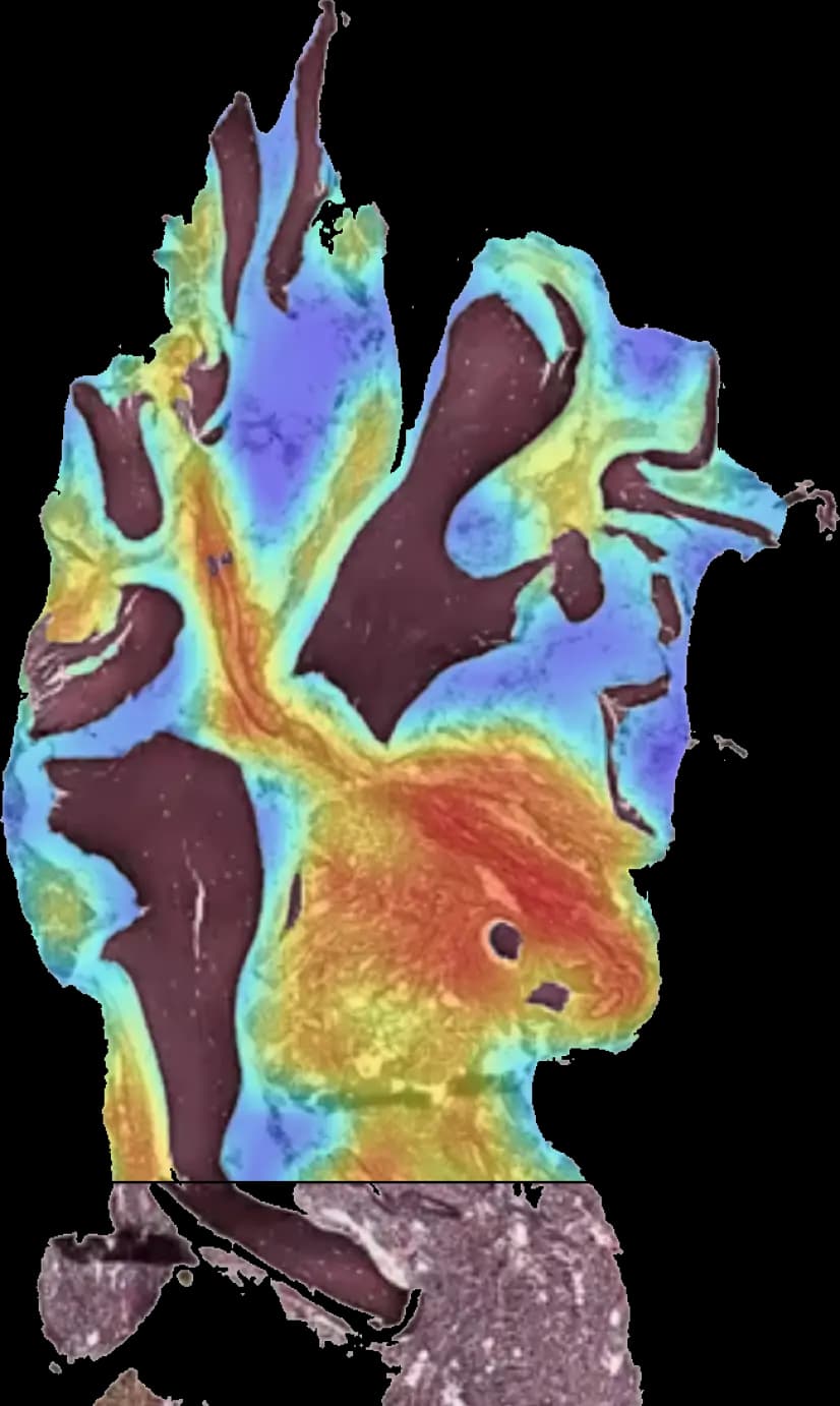 Heatmap of prognostic patterns