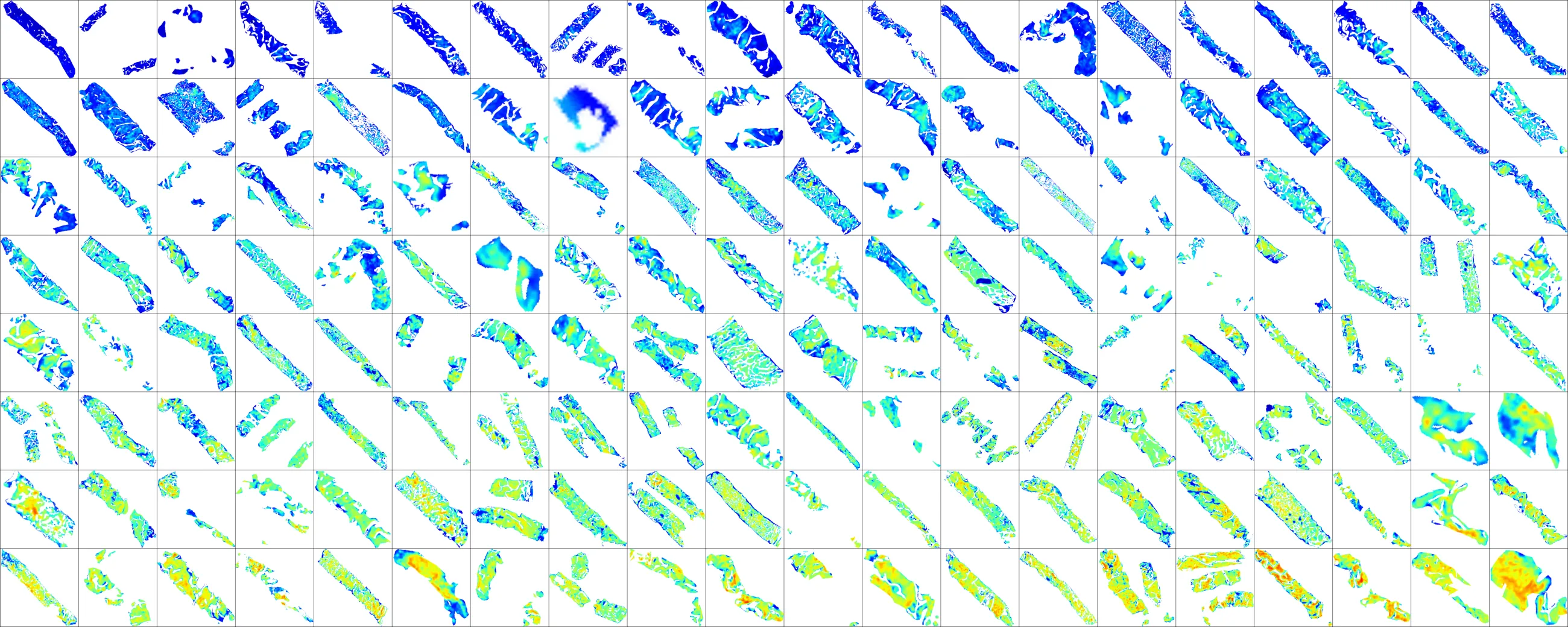 Quantified fibrosis across a cohort of trial MPNs