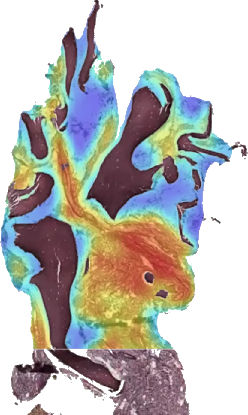 Heatmap of prognostic patterns